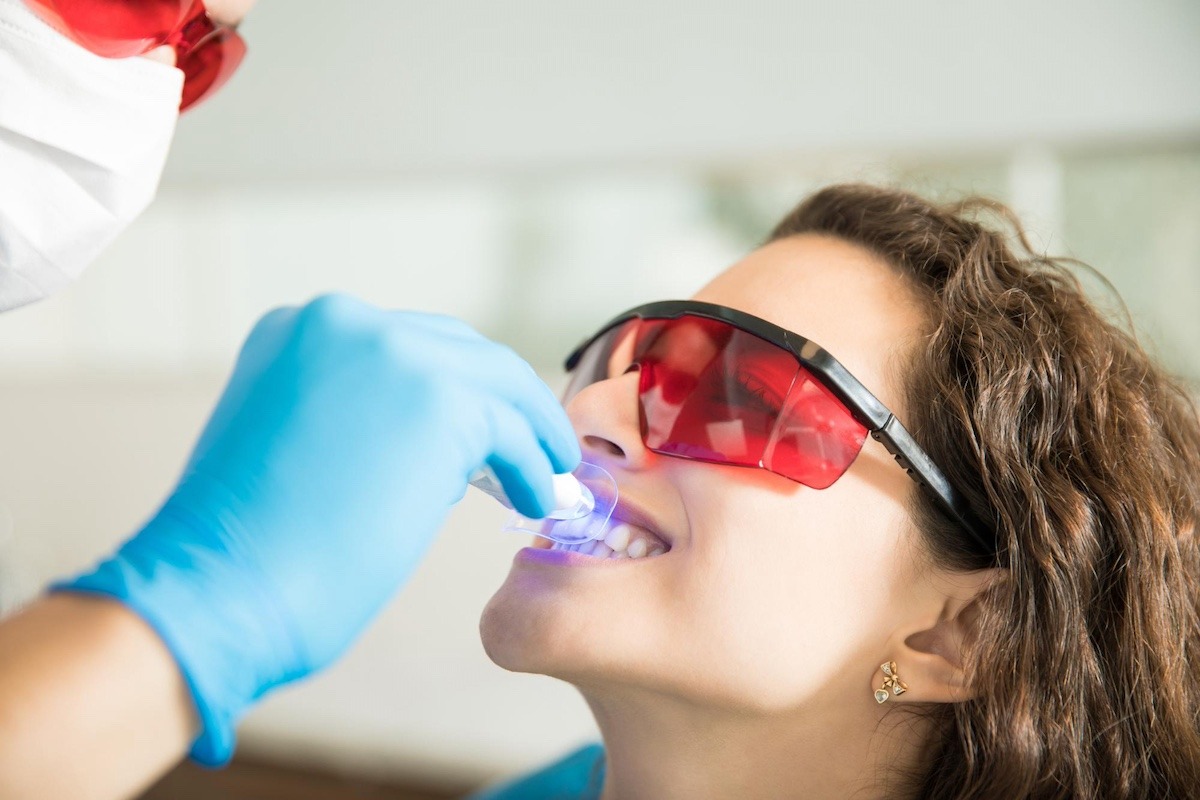 Is it safe to whiten your teeth with laser?