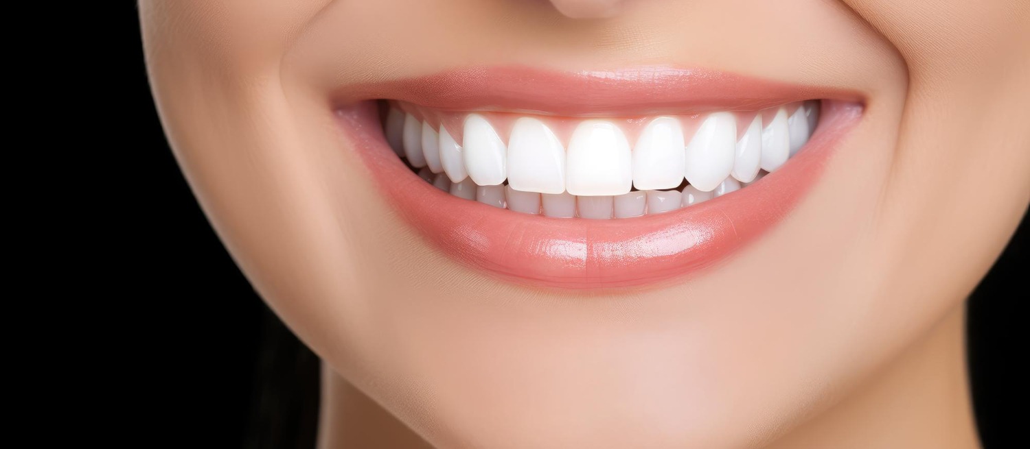 Enhance Your Smile with Composite Veneers by Dr. Vesna